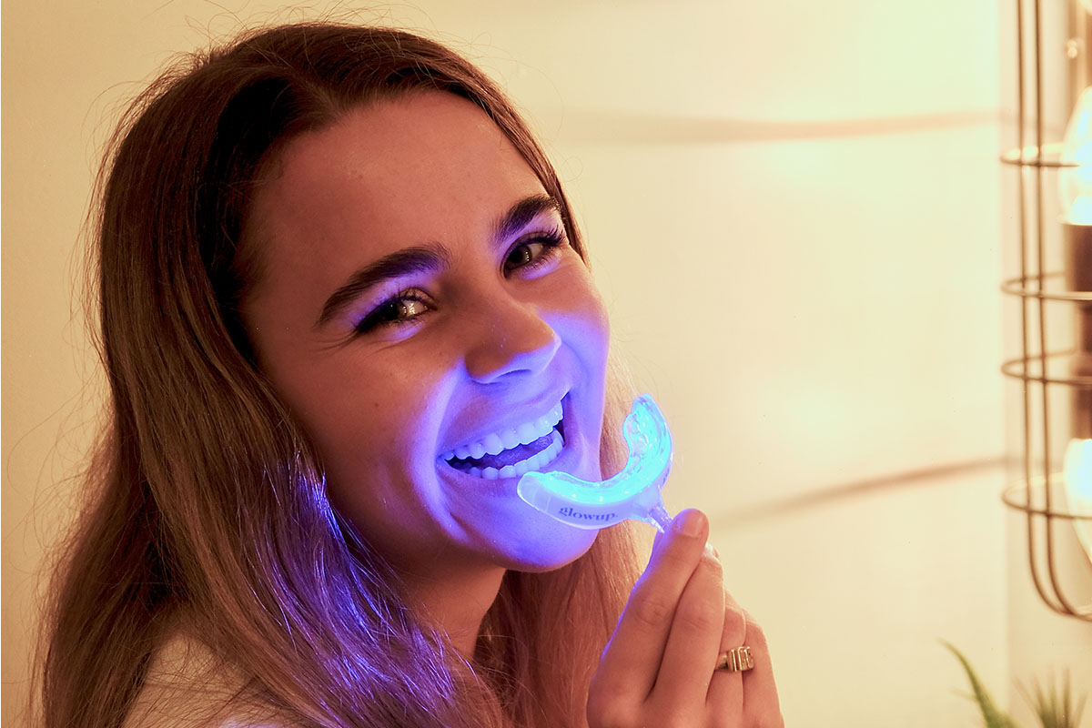 glowup. Personalized Teeth Whitening Kit Voucher, on sale for $39.99 through 9/20