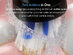 AquaSonic ProSpin Whitening Toothbrush