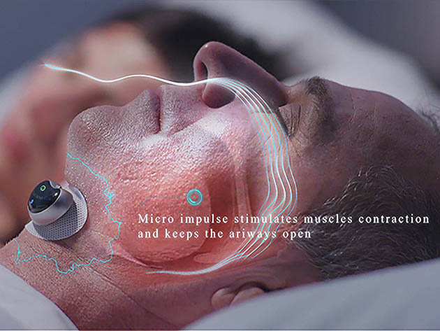 Snore Circle Anti-Snoring Sleep Aid Muscle Stimulator