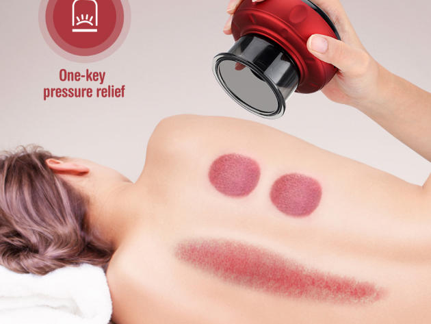 Smart Cupping Therapy Massager